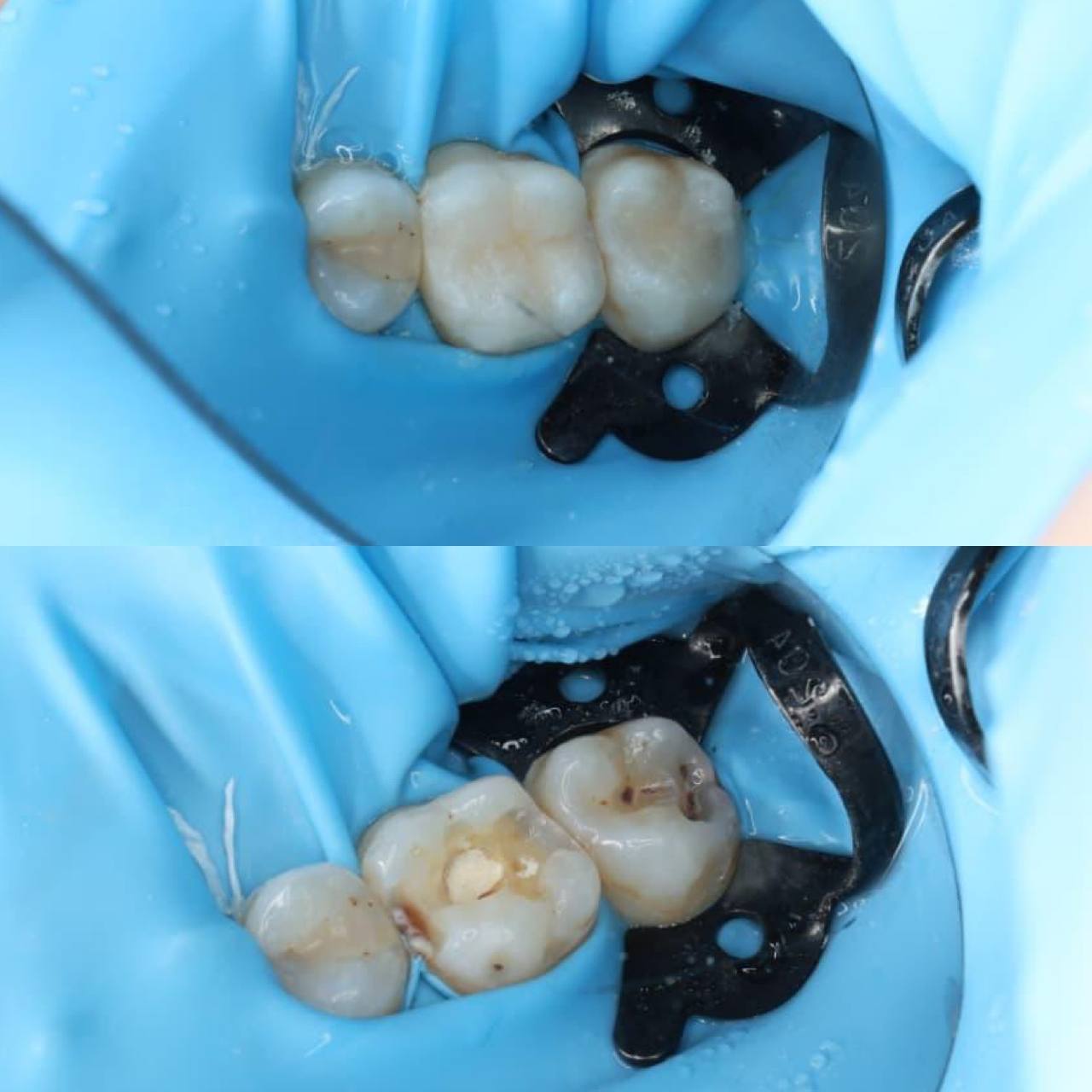 service-dental-treatment