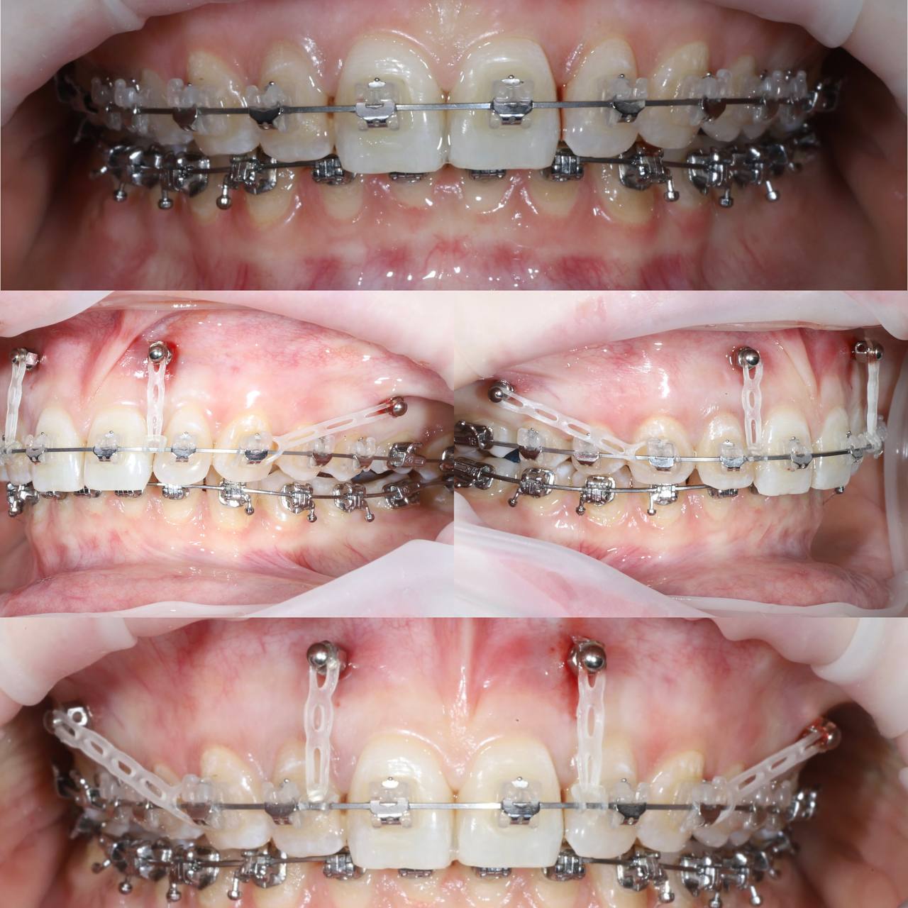 service-orthodontic-treatment