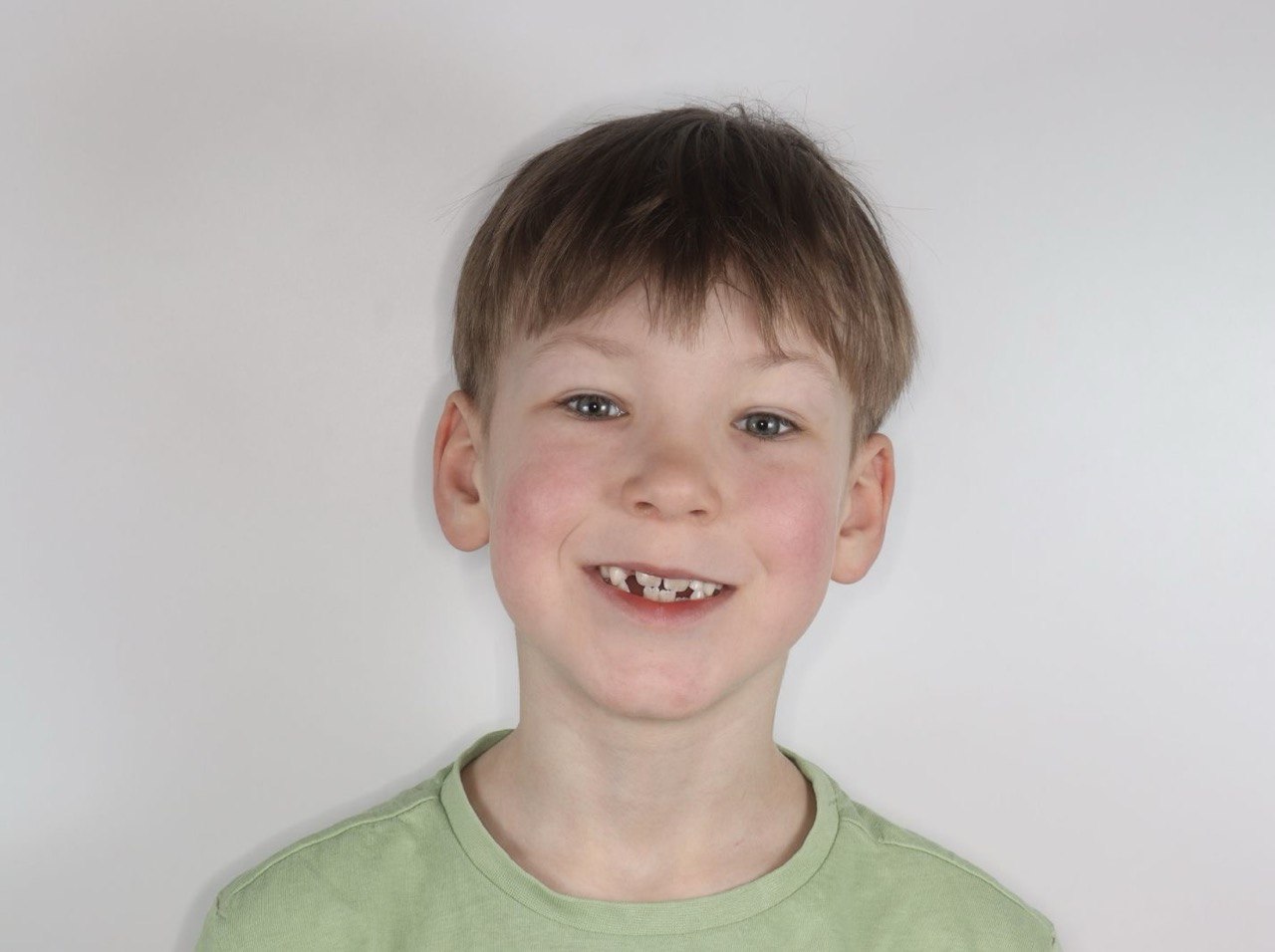 service-pediatric-dentistry