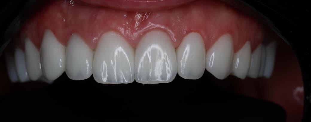 service-prostetic-dentistry